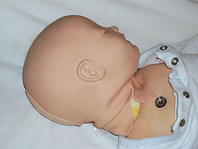 Repairing a tear in a Laerdal SimBaby's neck, this image shows the tear before the repair Repairing SimBaby with cyanoacrylate adhesive (before)