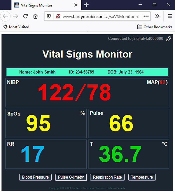 How to Read A Vital Signs Monitor 