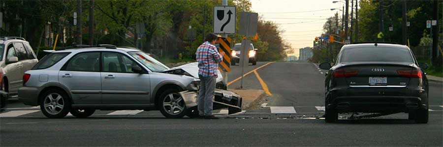 Motor vehicle accident (MVA). Creating realistic prosthetic appliances Motor vehicle accident (MVA). Creating realistic prosthetic appliances