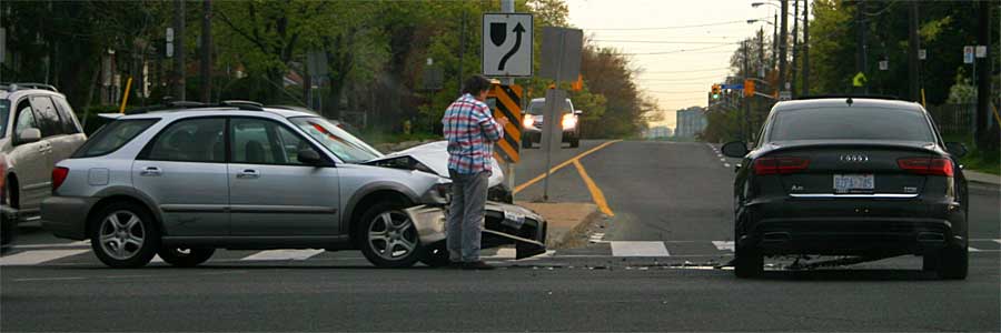 Motor vehicle accident (MVA). Creating realistic prosthetic appliances